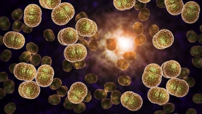 gonorrhoea
