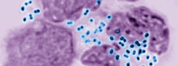 Click to enlarge Neisseria gonorrhoeae