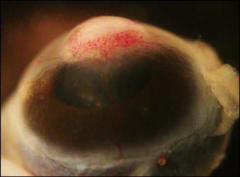 Eye 1
