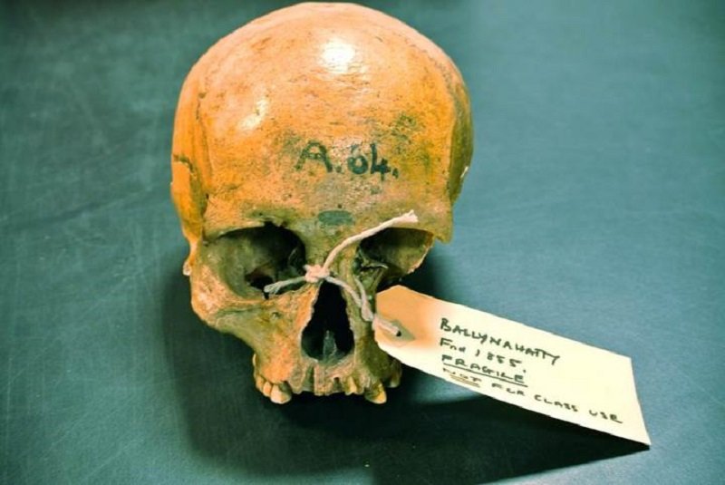 Click to enlarge Ancient Skull