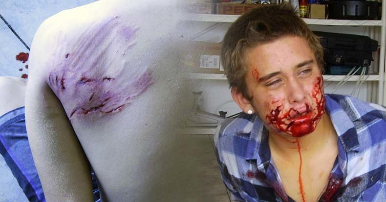 Click to enlarge child mauled by police dog
