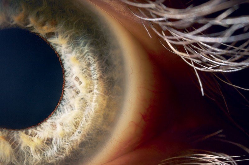 Click to enlarge eye closeup