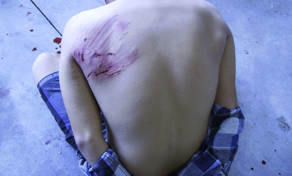 Click to enlarge Jared Lemay, police brutality, k9