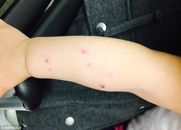 dog Bite marks