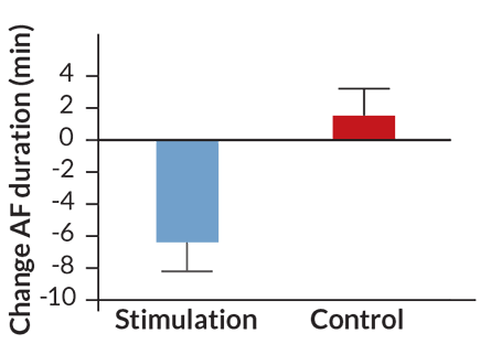 Click to enlarge vagus