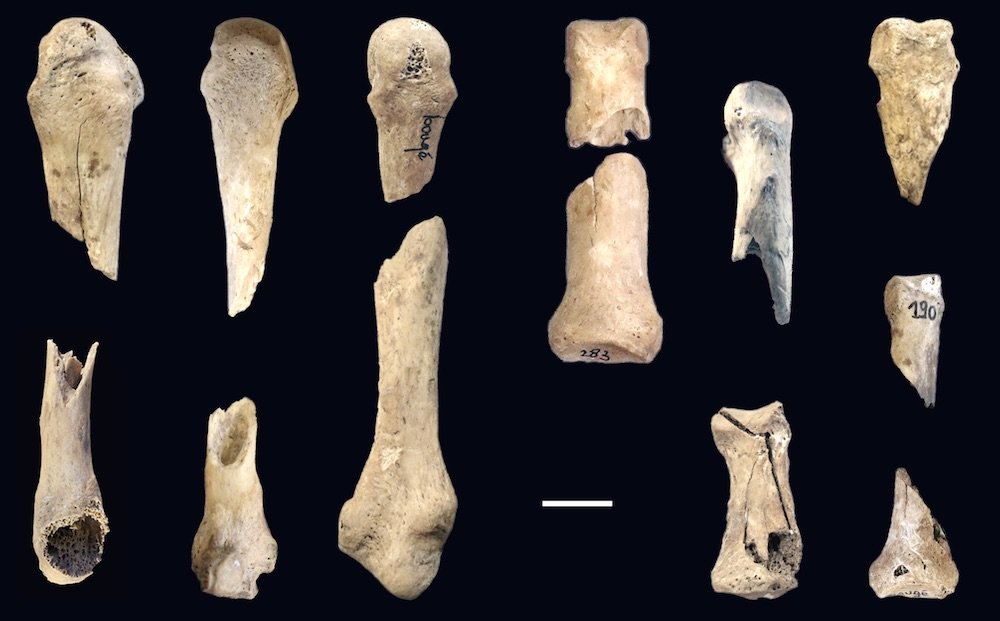 Severed Bones in Pit