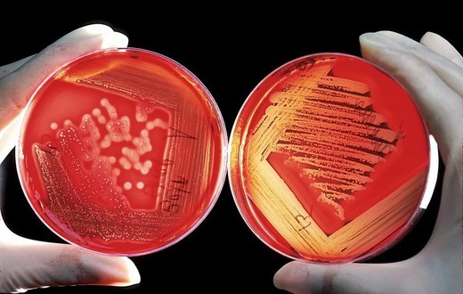Petri dishes