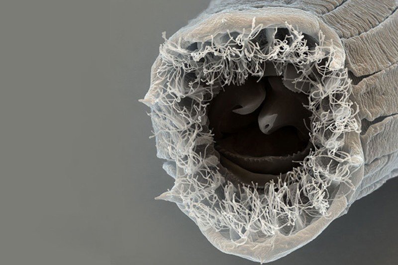 Click to enlarge nematode, shape-shifting worm