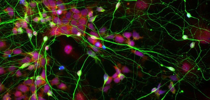 Click to enlarge brain cells cocaine autophagy cannibalism
