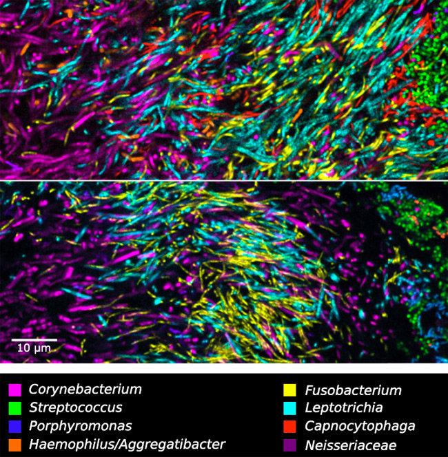 mouth microbiome