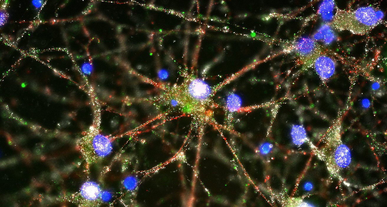synapses of primary human neurons