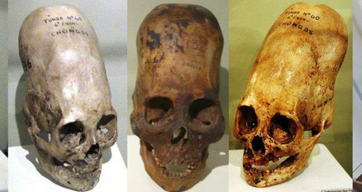elongated skulls