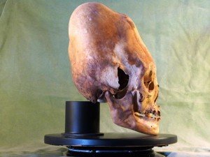 elongated skull