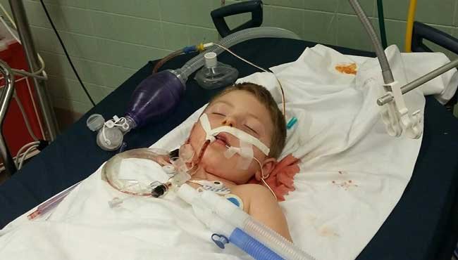 Click to enlarge Michael Bulger, of Eight Mile, says his 6-year-old son Andrew was attacked by a pit bull Monday night at approximately 6:30 p.m.