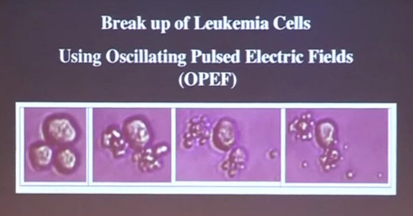 Click to enlarge leukemia cells sound waves