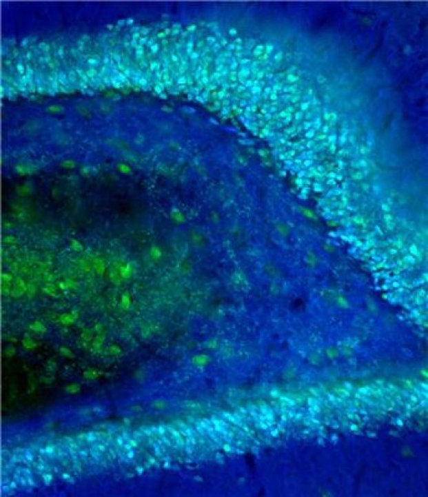 Click to enlarge granual cells brain