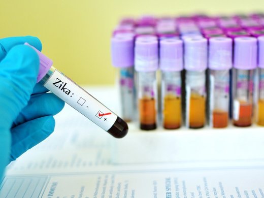 Zika-Virus