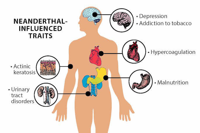 Click to enlarge Neanderthal traits