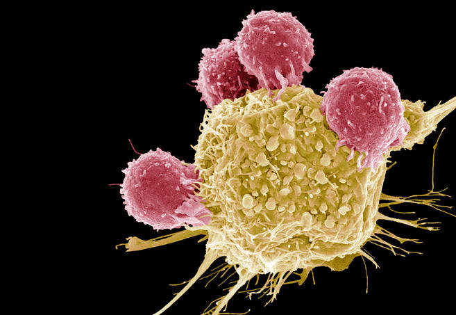 Click to enlarge micrograph of T cells (pink) attacking a cancer cell