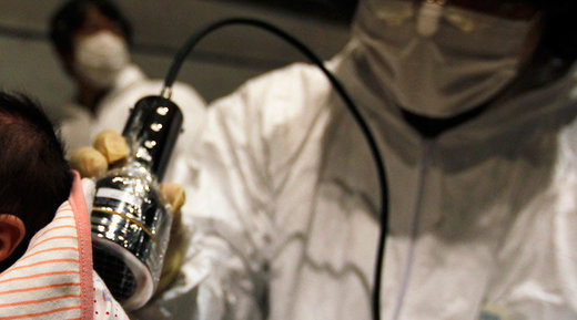 radiation exposure