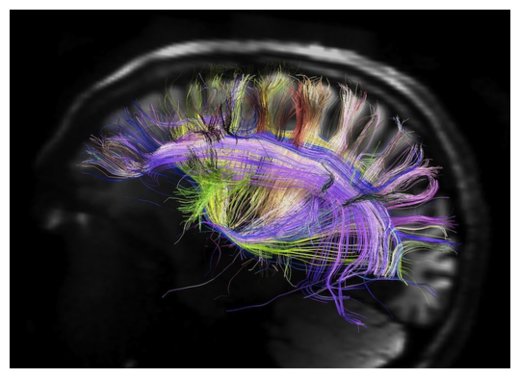 Human Brain