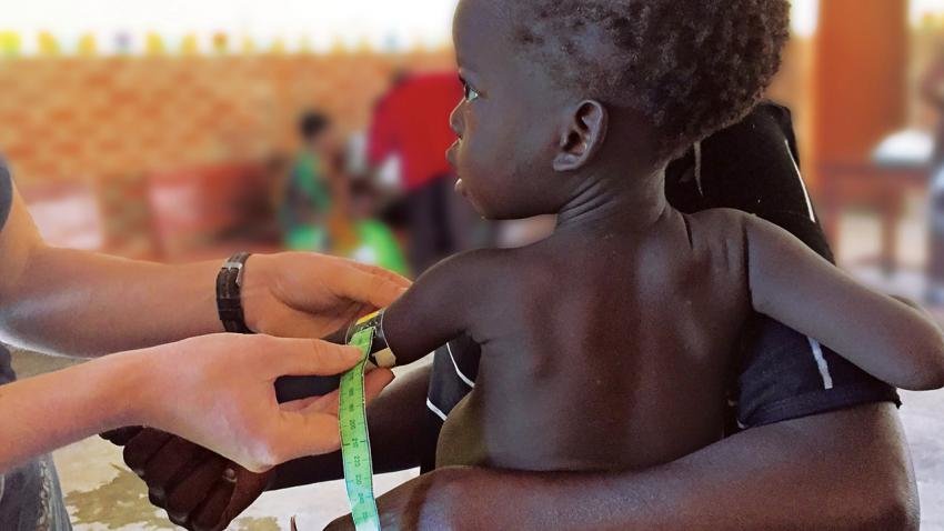 Click to enlarge malnurished African child