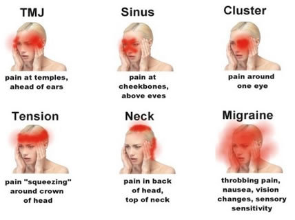 headaches