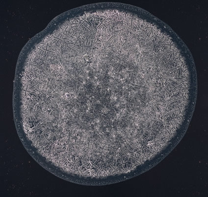 basal tear