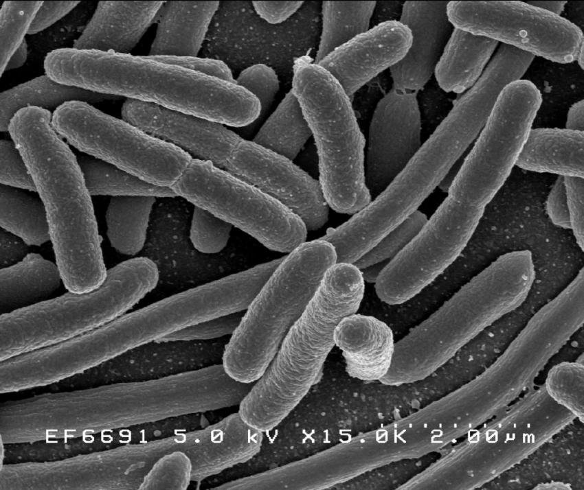 Click to enlarge Escherichia coli, E coli bacteria
