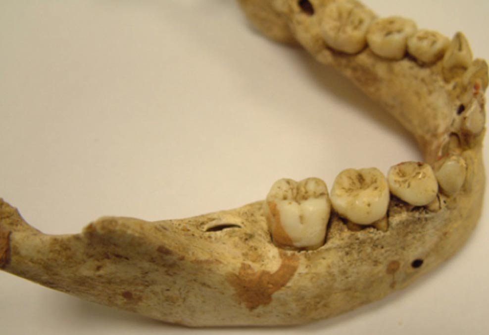 Medieval children's milk teeth