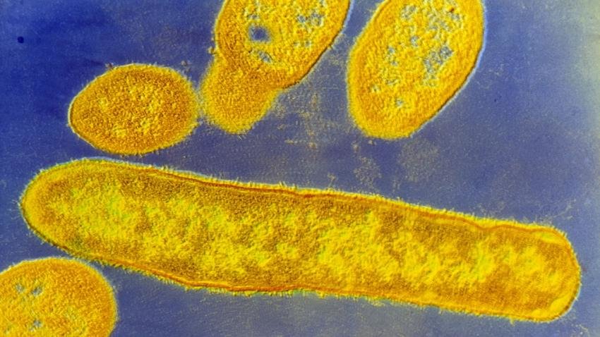 Click to enlarge bacteria