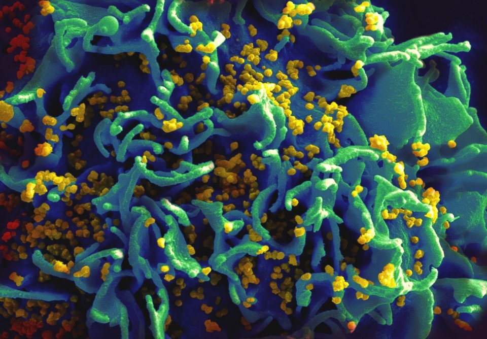 HIV retrovirus