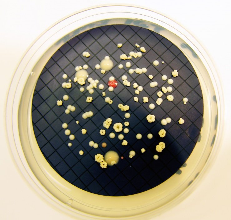 Click to enlarge mycobacterium