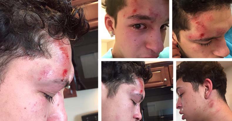 cop beats 15 yr od