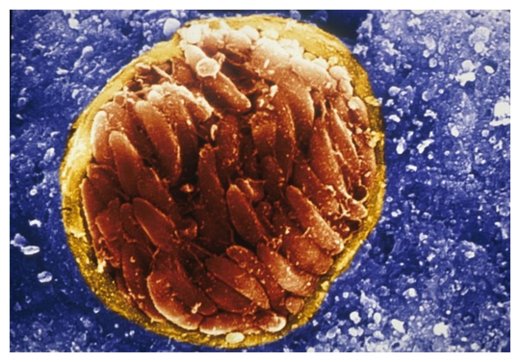 Toxoplasma gondii