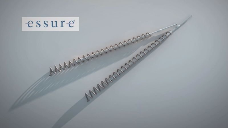 essure birth control