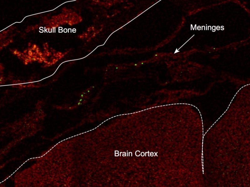 immune cells gut bacteria