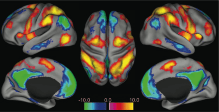 Click to enlarge brain pictures