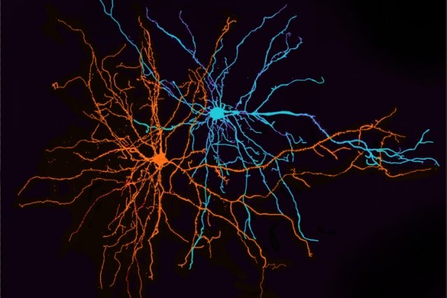 neurons amygdala