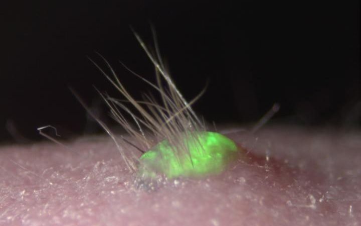 lab grown skin