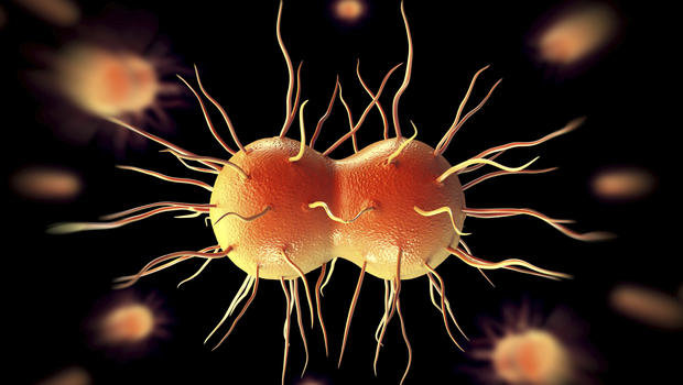 Gonorrhea