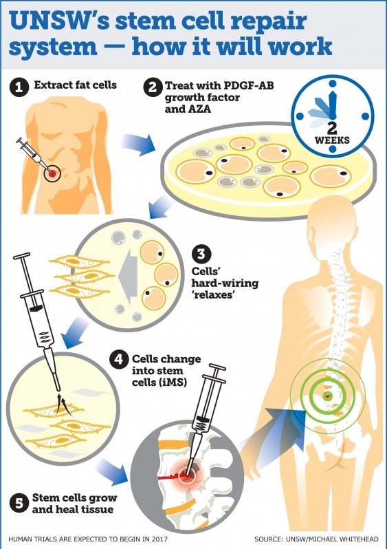 Click to enlarge stem cell repair