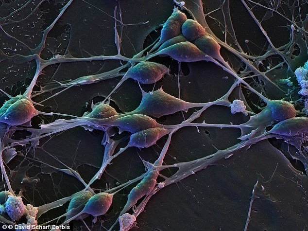 Click to enlarge Brain cells