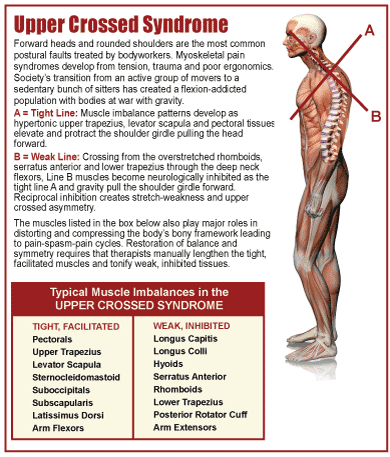 Posture
