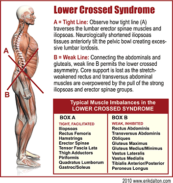 posture