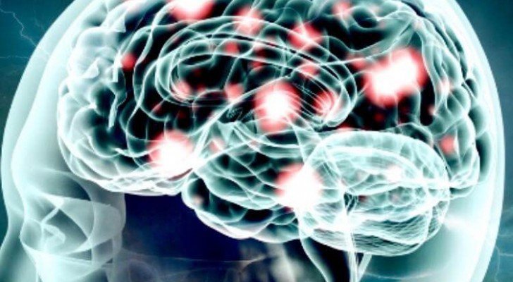 Click to enlarge brain firing