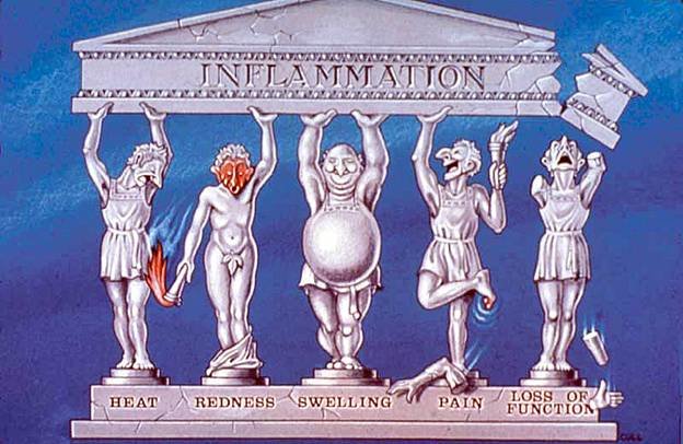 Click to enlarge inflammation
