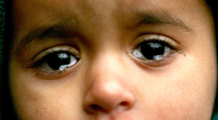 child starving
