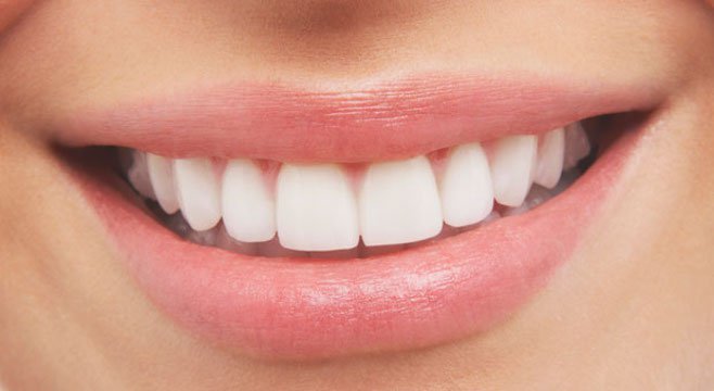 Click to enlarge smile