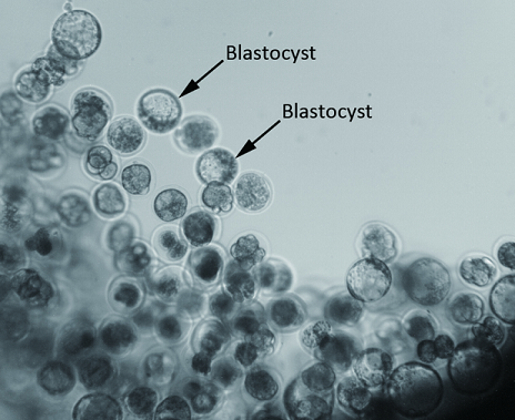 blastocytes